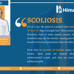 What is cure for scoliosis?